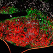 Tumor Immunology