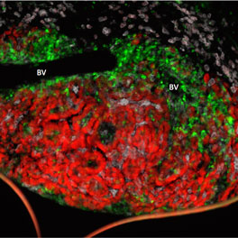 Tumor microenvironment