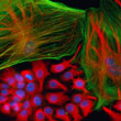 Tumor Microenvironment